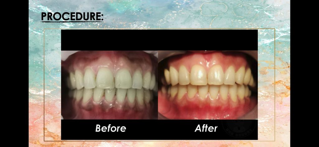 Dental Case Studies in Sabah